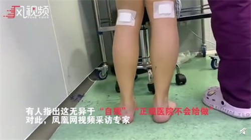 小腿肌肉阻断术是什么