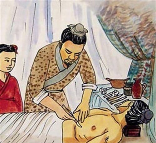 麻沸散的由来与传说
