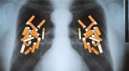 全球辐射最强的地方在哪里