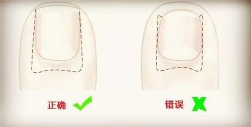 怎样正确剪指甲
